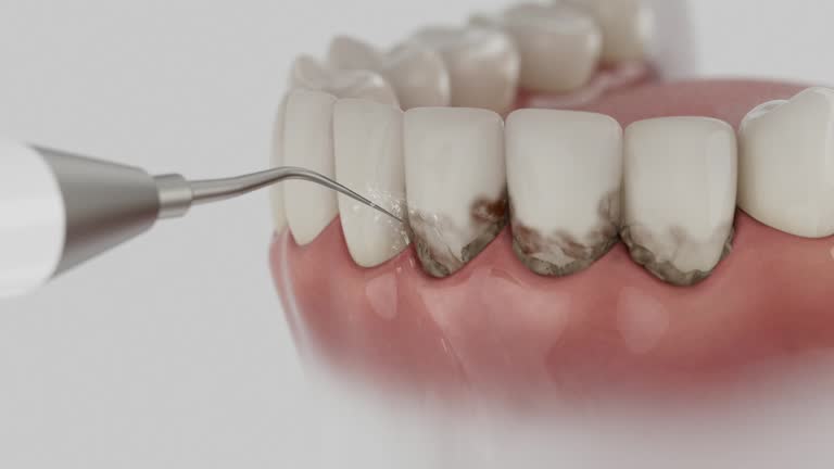 Reliable Dental contractor in Champion Heights, OH by Dentist Open Now
